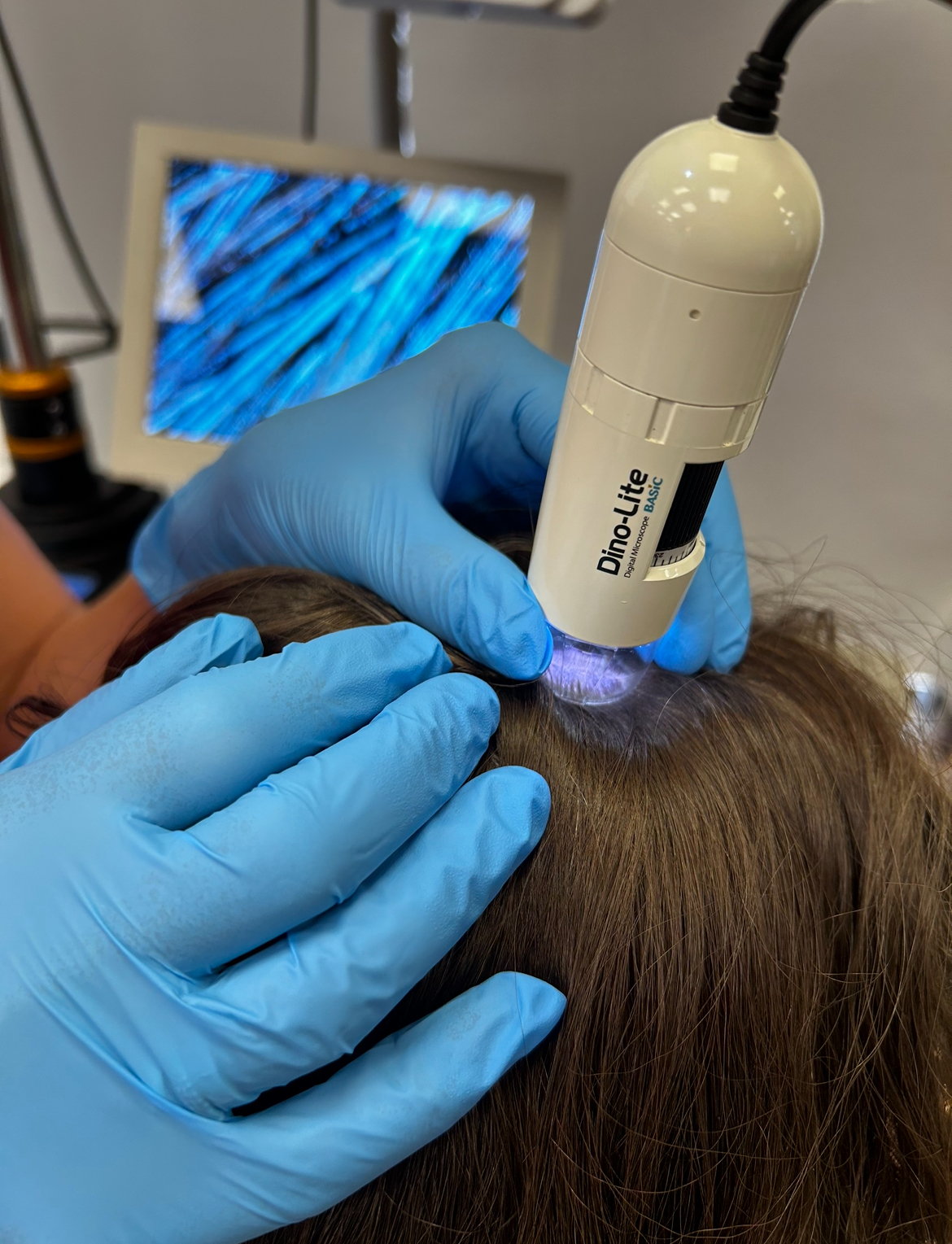 Analiza skóry głowy